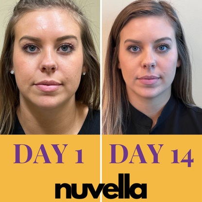 Sculptura Pro™ - 5 Minute Face Lift